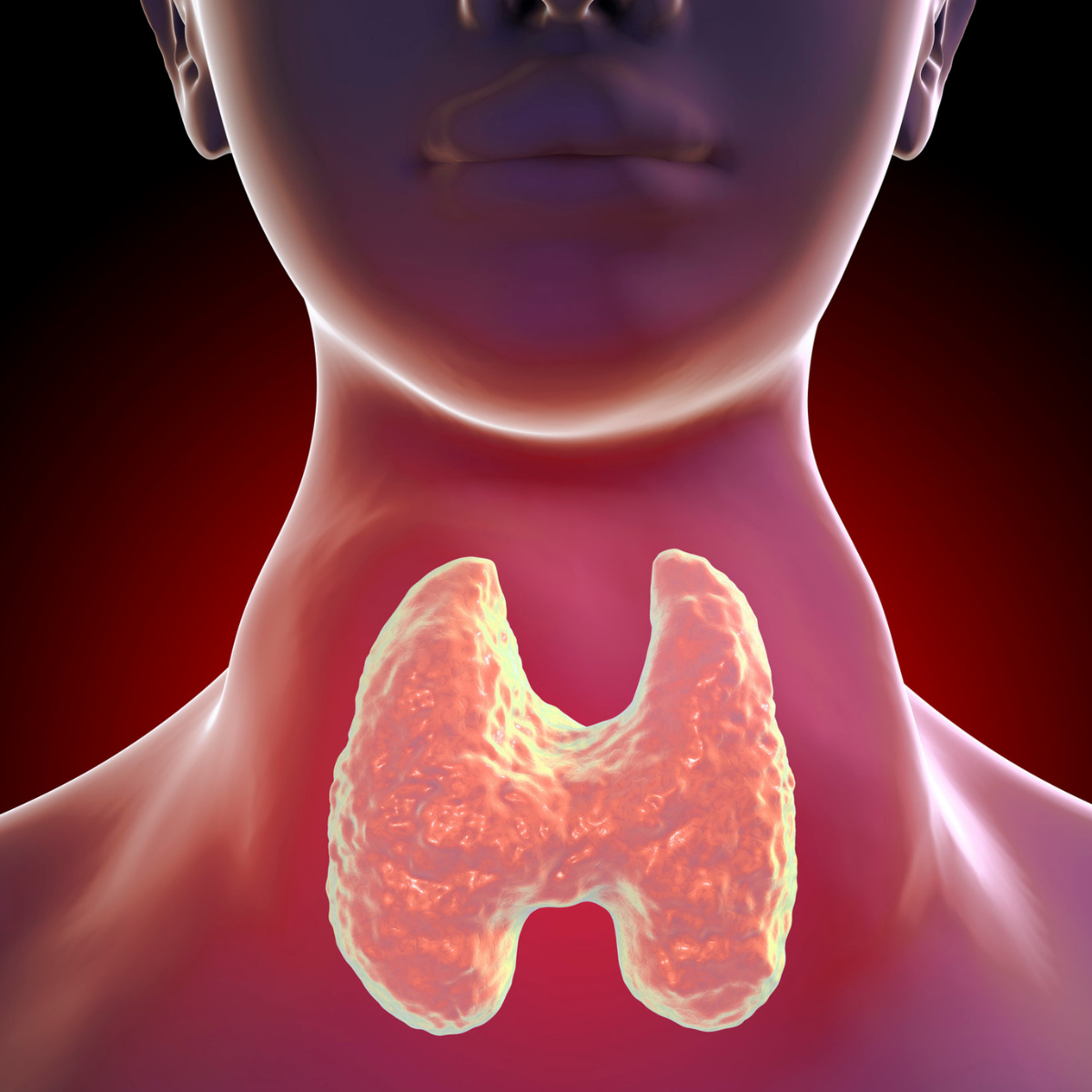 Hyperthyroidism